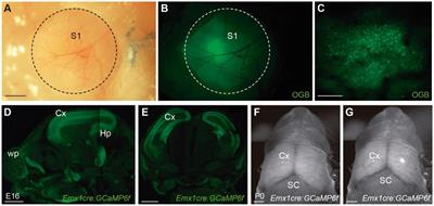 Mesoscale calcium imaging in vivo: evolution and contribution to developmental neuroscience